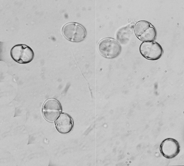 Symphytum Pollen